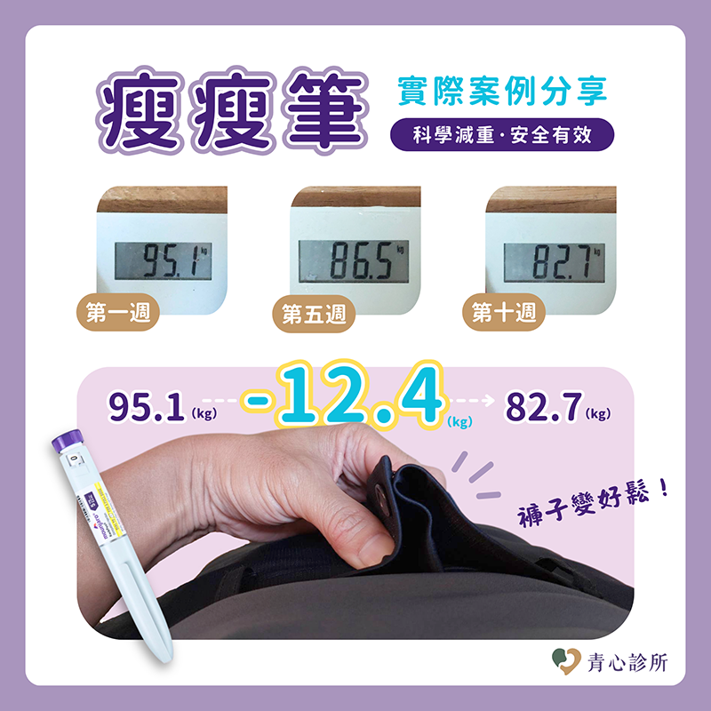 示意圖