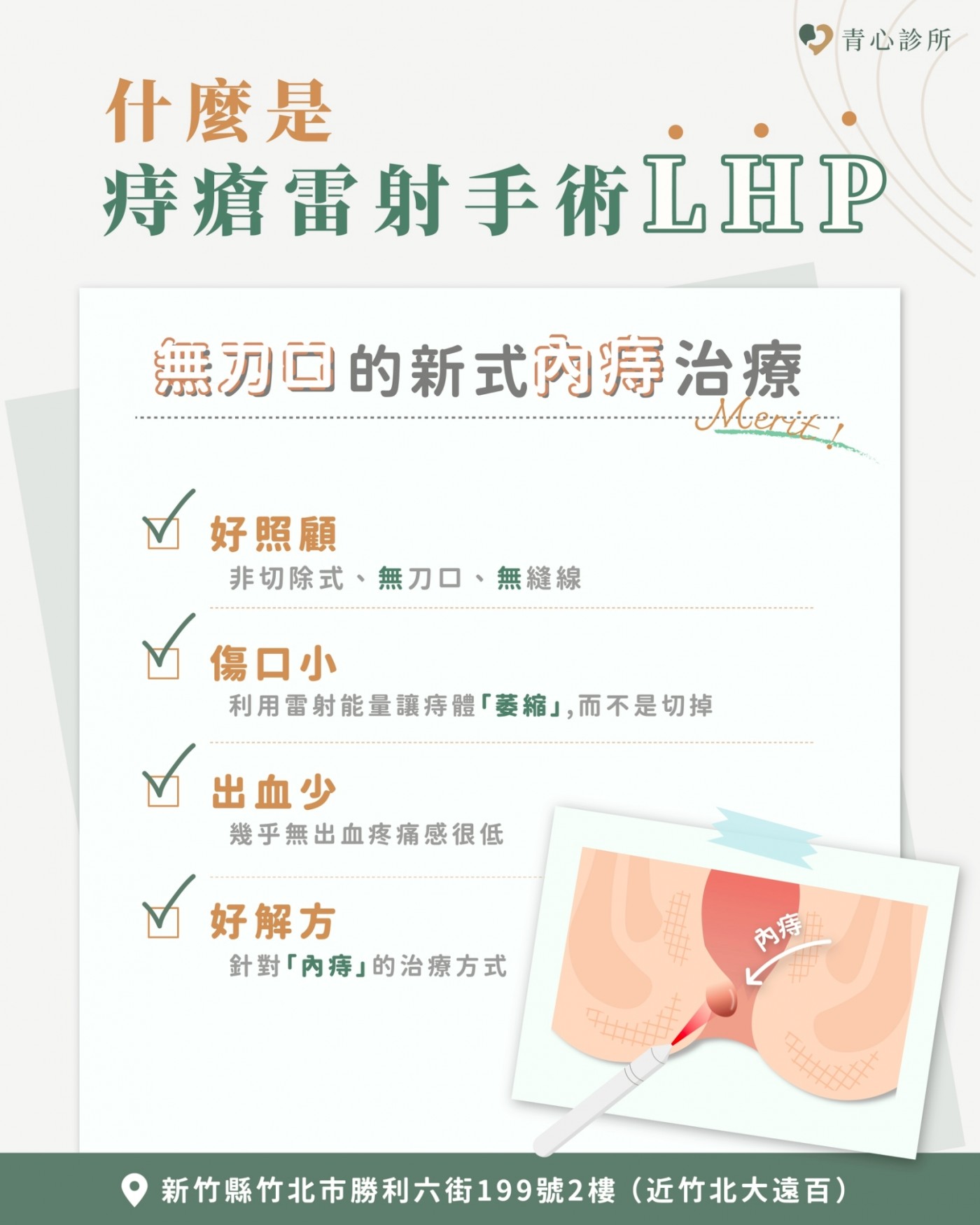 LHP痔瘡雷射手術示意圖